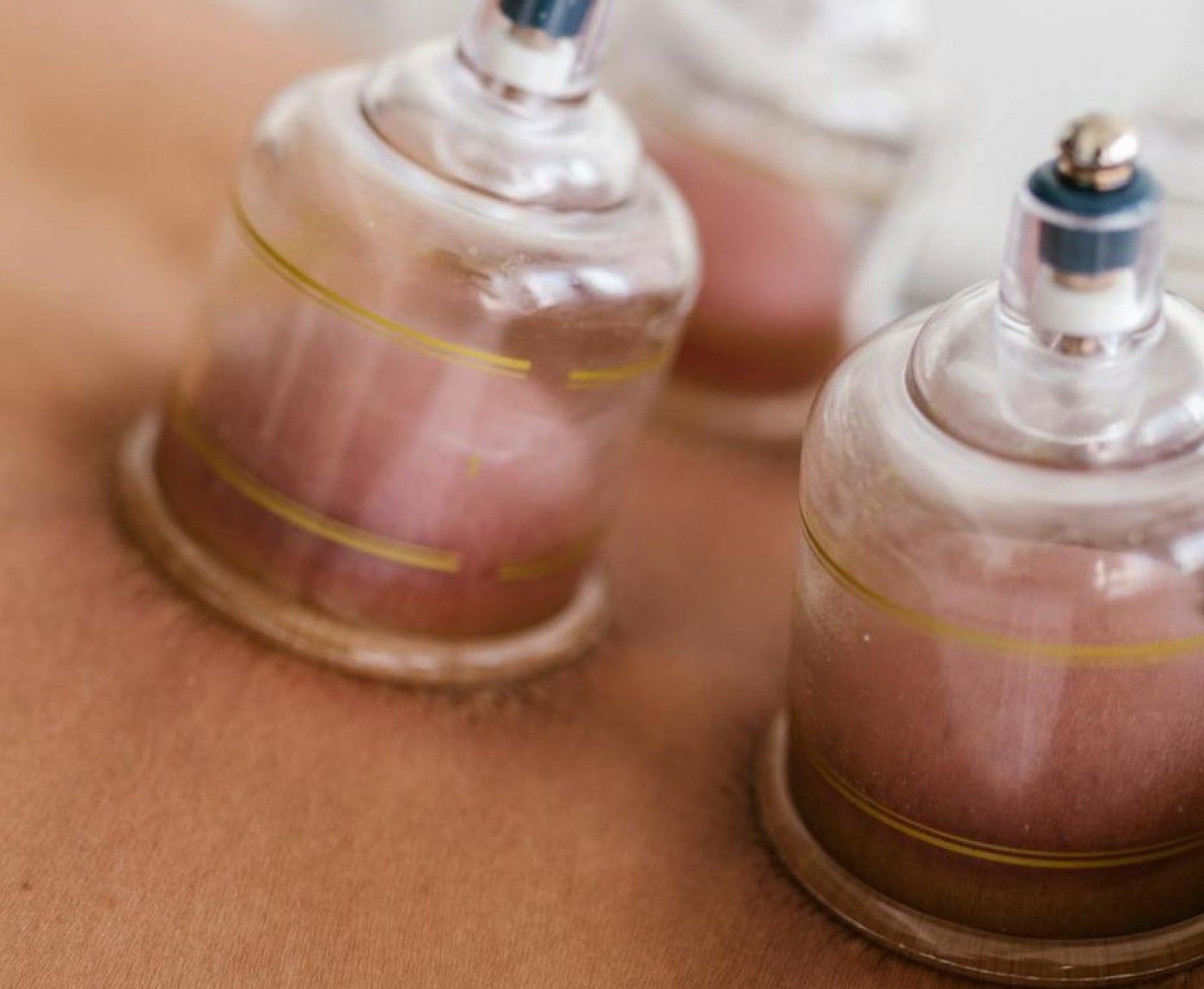 Hijama-Institut