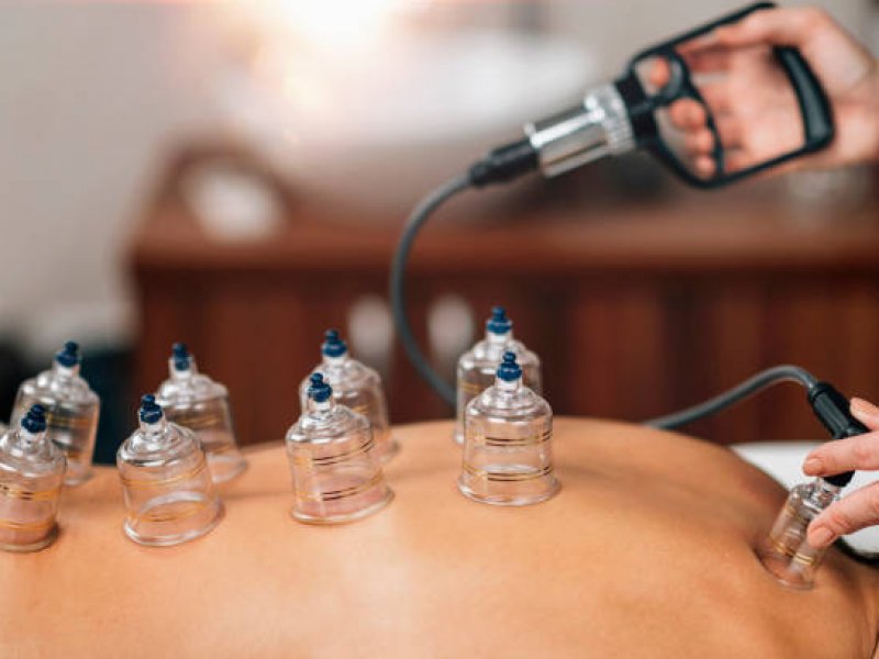 Hijama-Institut